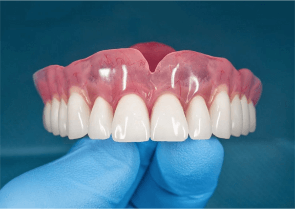 dentures